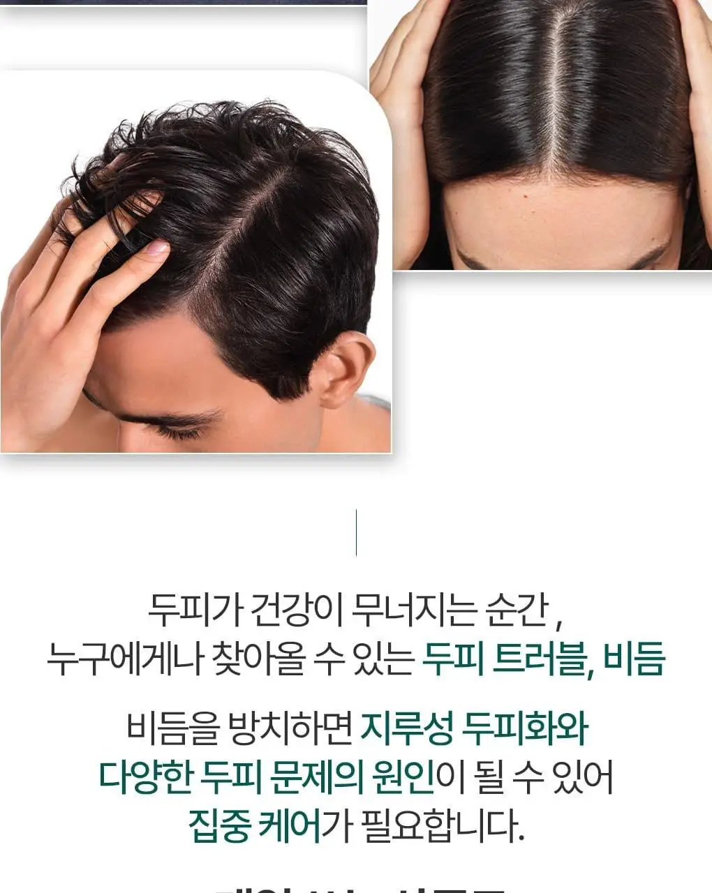 [지루성두피&가려움케어] 클로란 갈랑가 진저 비듬샴푸400ml 상세페이지 8